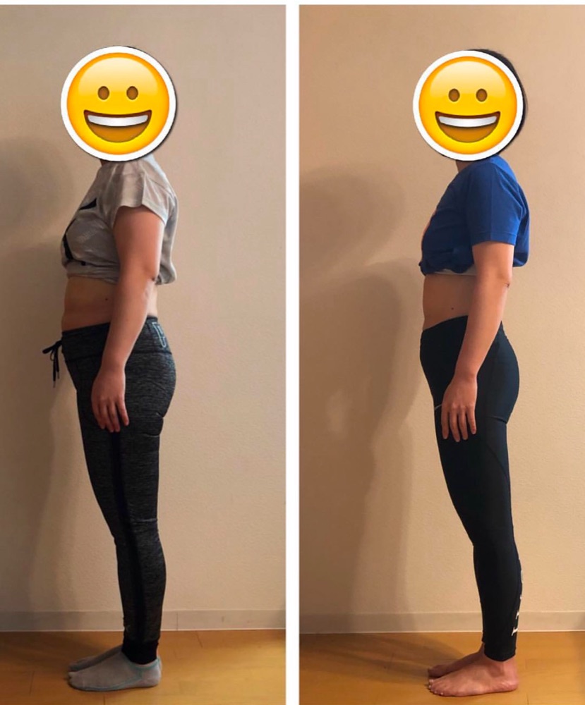 女性のお客様のビフォーアフター写真(横向き)