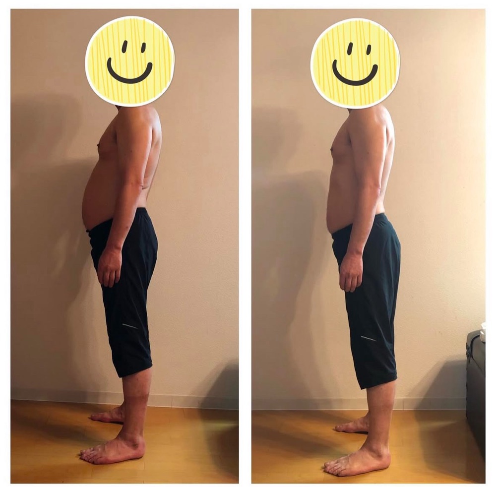 男性のお客様のビフォーアフター写真（横向き）
