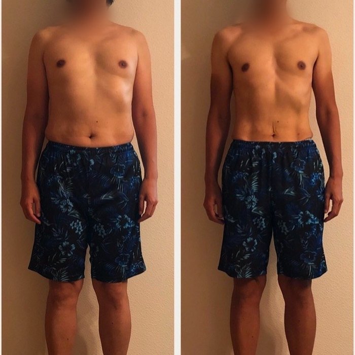 男性のお客様のビフォーアフター写真(正面)