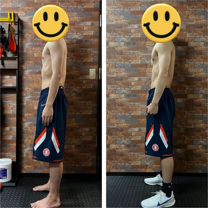 男性のお客様のビフォーアフター写真(横向き)