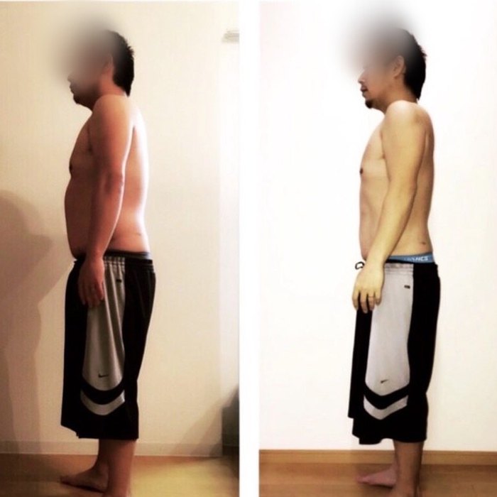 男性のお客様のビフォーアフター写真（横向き）